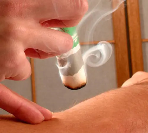 ASAG (Acupuntura sem Agulha) - Paula Pereira