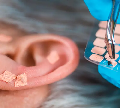 Auriculoterapia - Paula Pereira